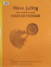 Image of Mata juling (strabismus) : patologi dan pemeriksaan