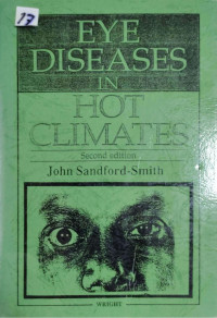Image of Eye diseases in hot climates